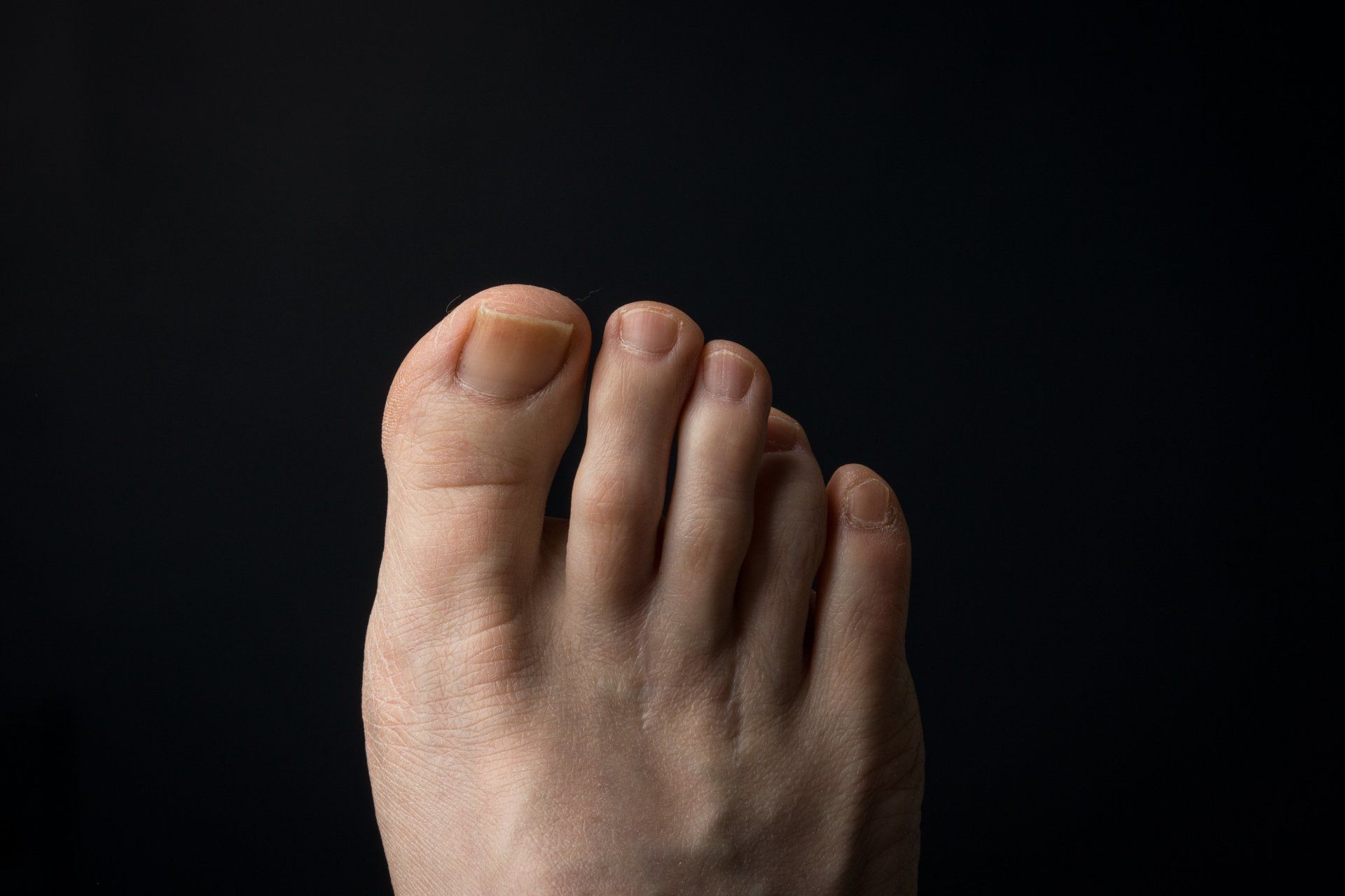 Why Does the Ball of My Foot Hurt?