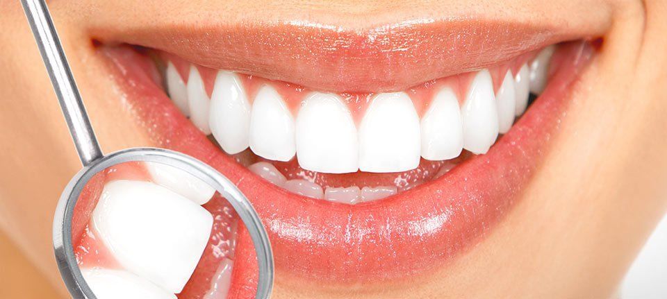 Affordable tooth whitening in Thame