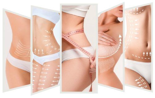 Chirurgia plastica per il corpo