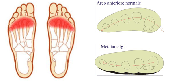 Patologie Del Piede | Torino | Podologia Mattioni