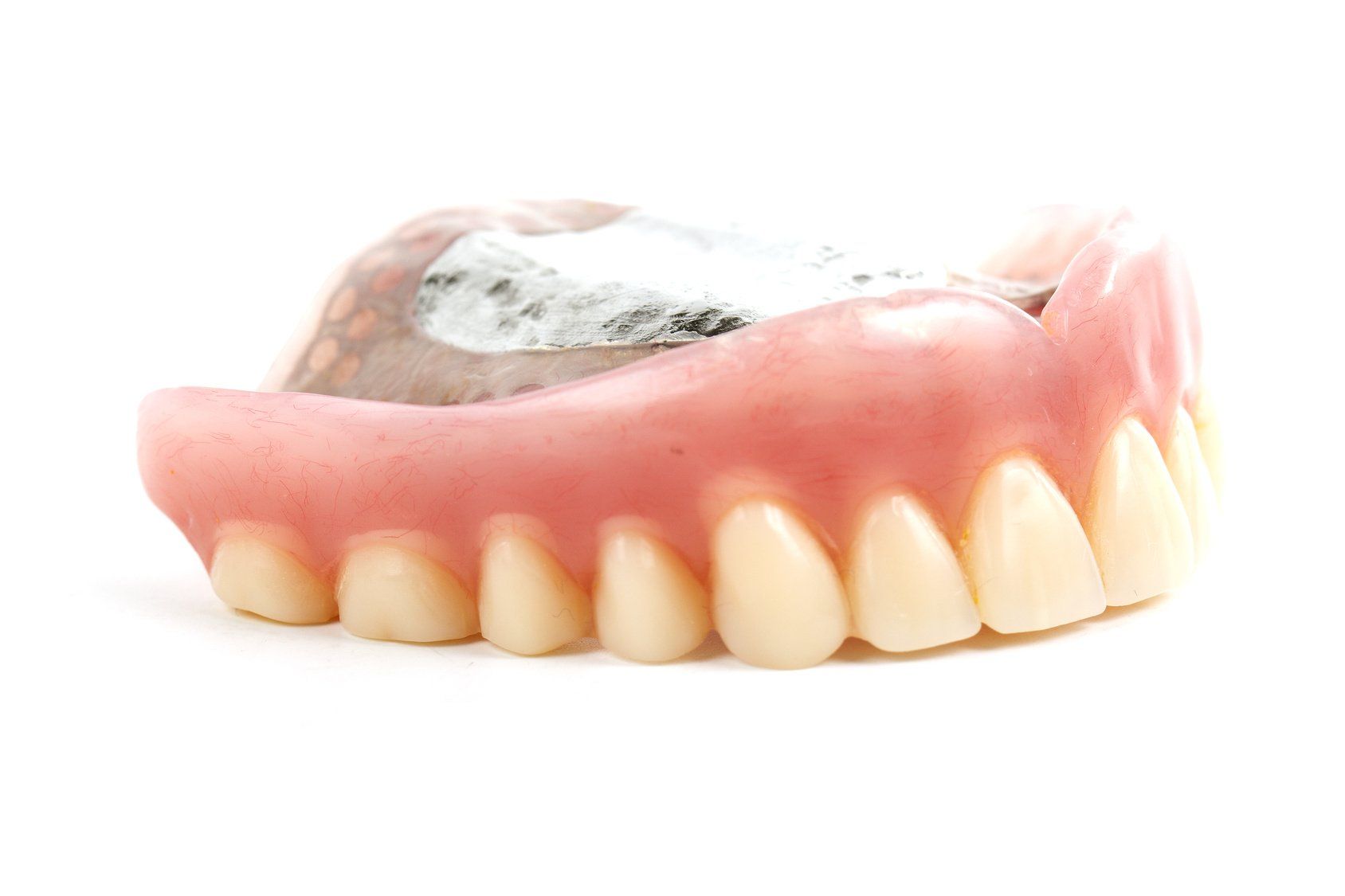 Should You Get a Soft Liner for Dentures?