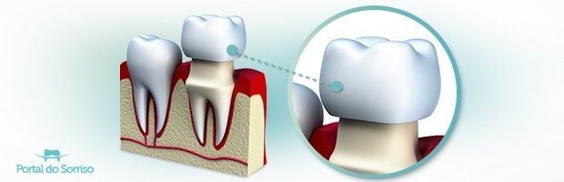 O Que É Dentistica  . Que É Realizada Em Uma Instituição De Ensino Visando.