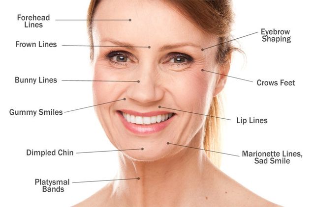 Anti Wrinkle Injections