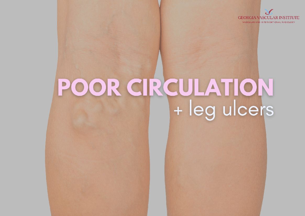 How To Improve Your Vascular Health how-to-improve-your-vascular-health