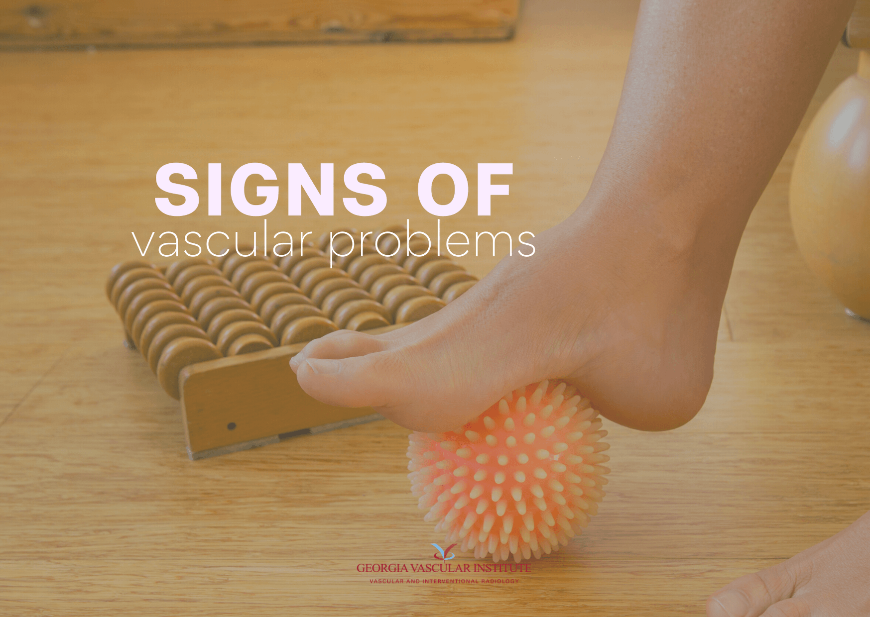 Common Signs of Vascular Problems
