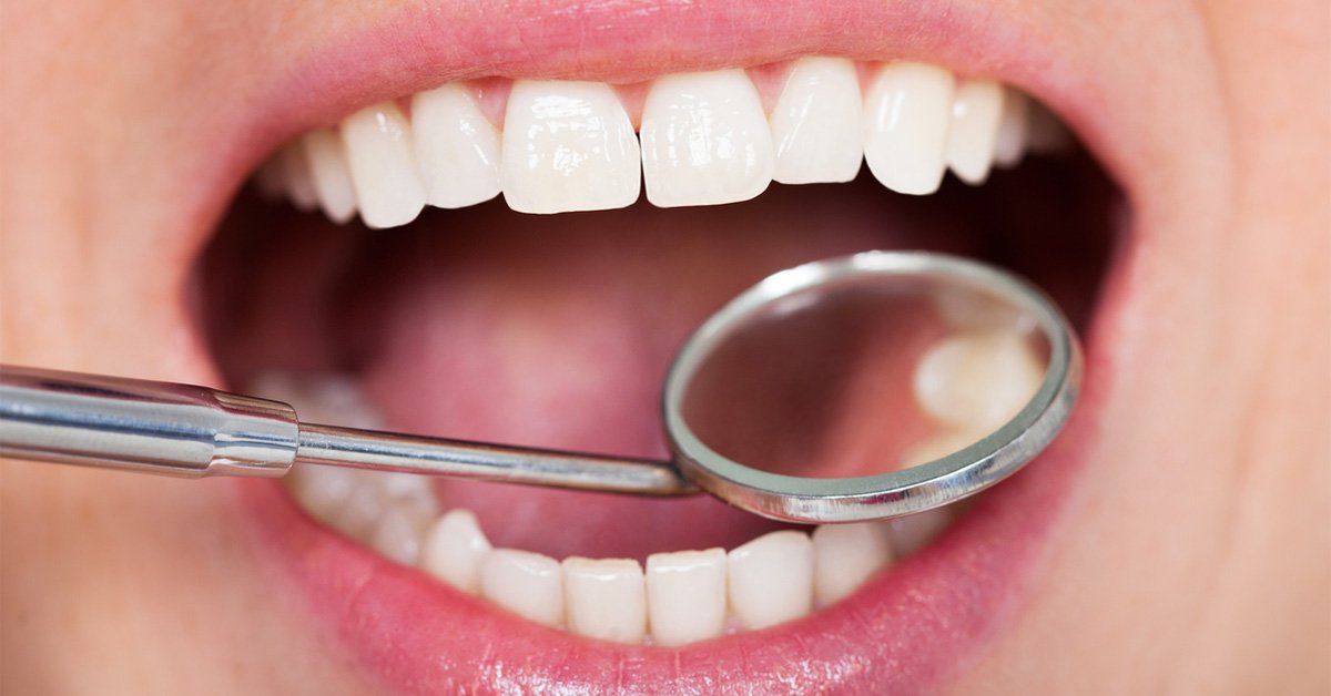 Tooth Filling Options Metal or Composite? Tooth Filling Options Metal or Composite?