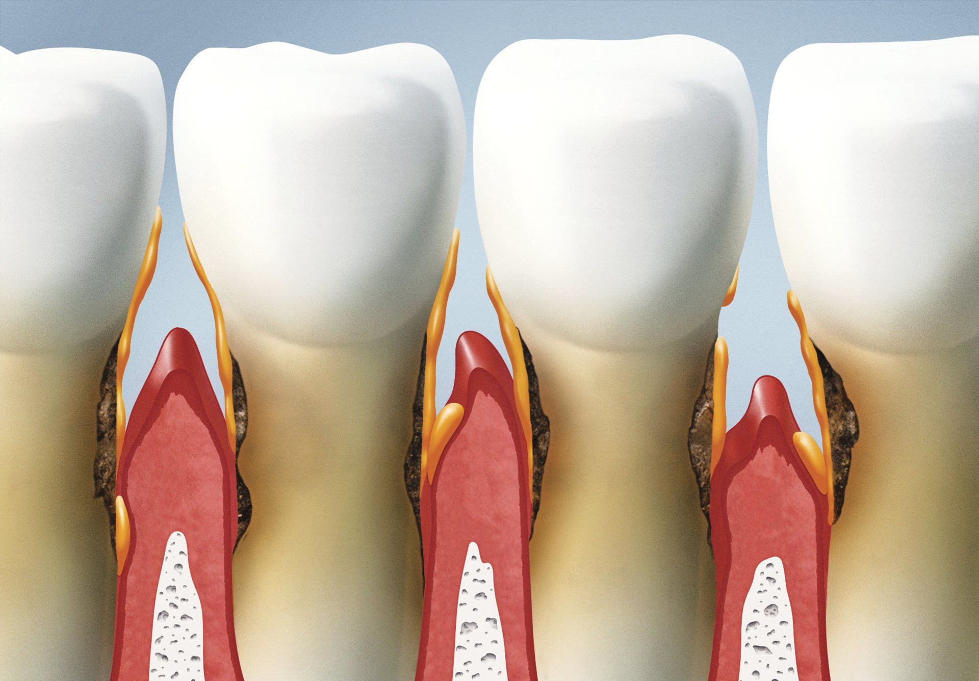 Galleria Periodontics & Implants