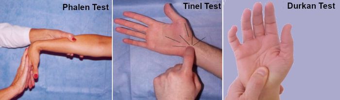 carpal tunnel test