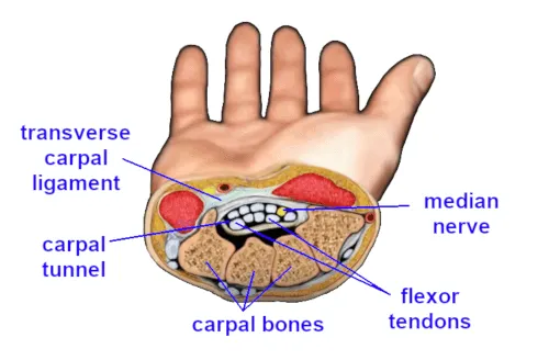 How Carpal Tunnel Forearm Massage Compares with Surgery