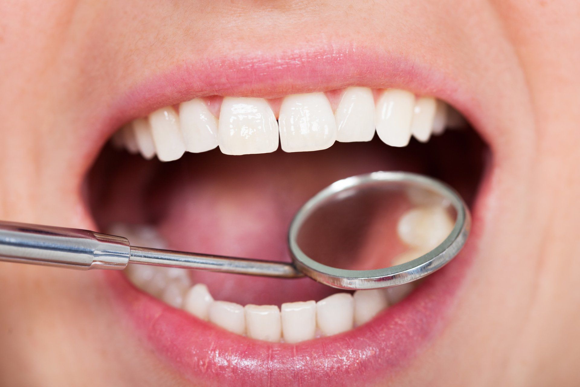 Amalgam Vs. Composite Fillings What's the Difference?