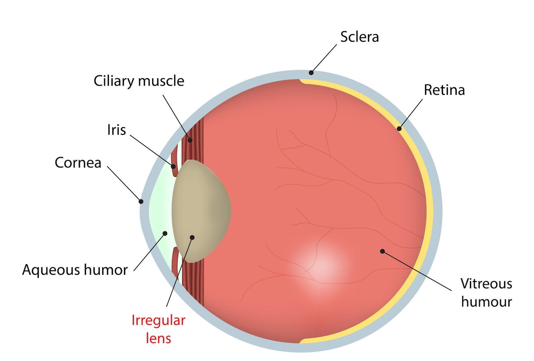 Susquehanna Eye Associates