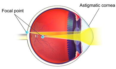 Susquehanna Eye Associates