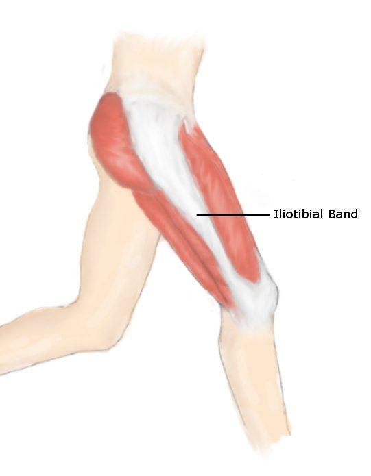 Iliotibial tract мышца