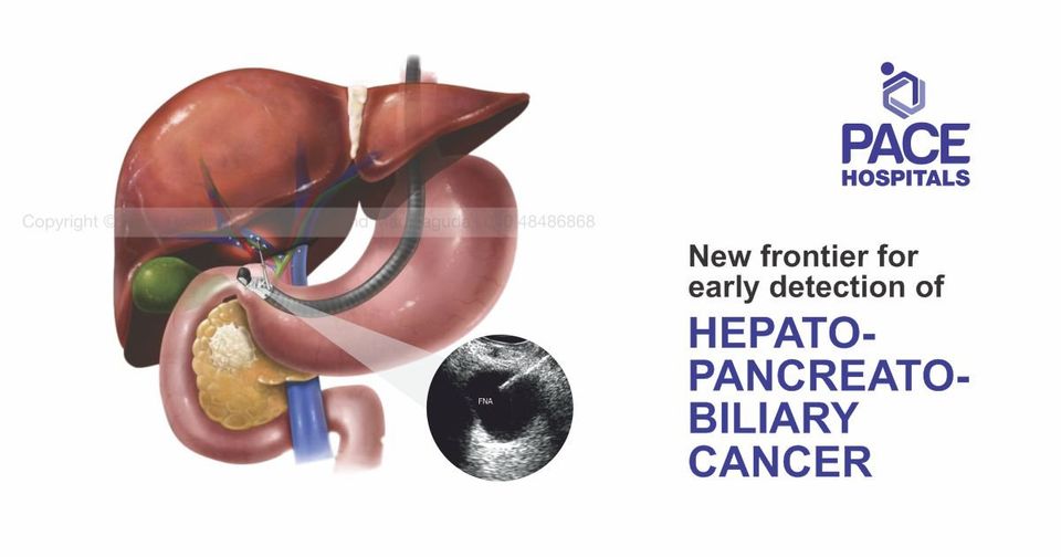 Endoscopic Ultrasound (EUS) New frontier for early detection of HEPATO