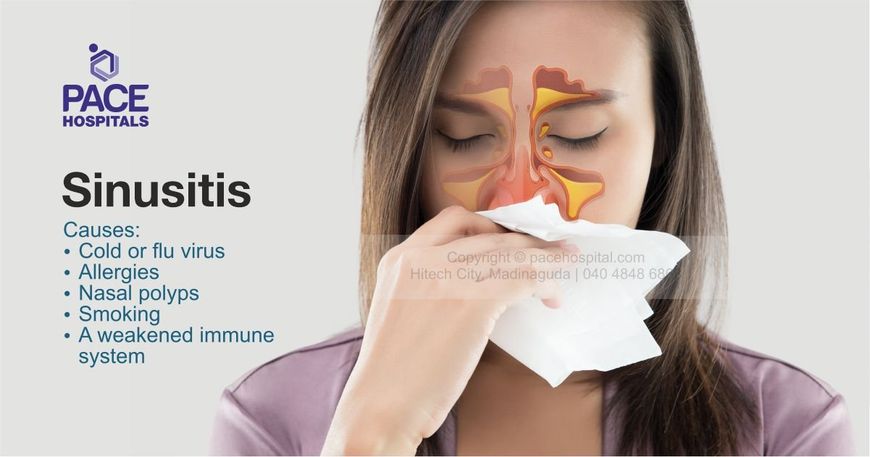 Sinusitis: Types, Causes, Symptoms and Treatment