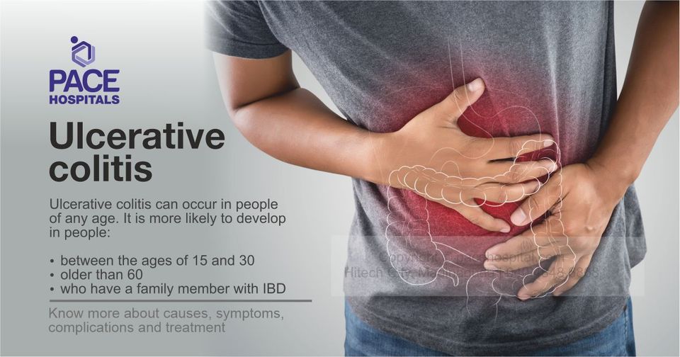 Ulcerative Colitis Causes Symptoms Complications And Treatment 3350