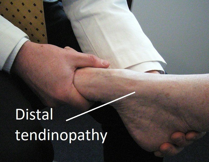 Ankle Tendon Dr Ben Beamond Orthopaedic Surgeon Adelaide