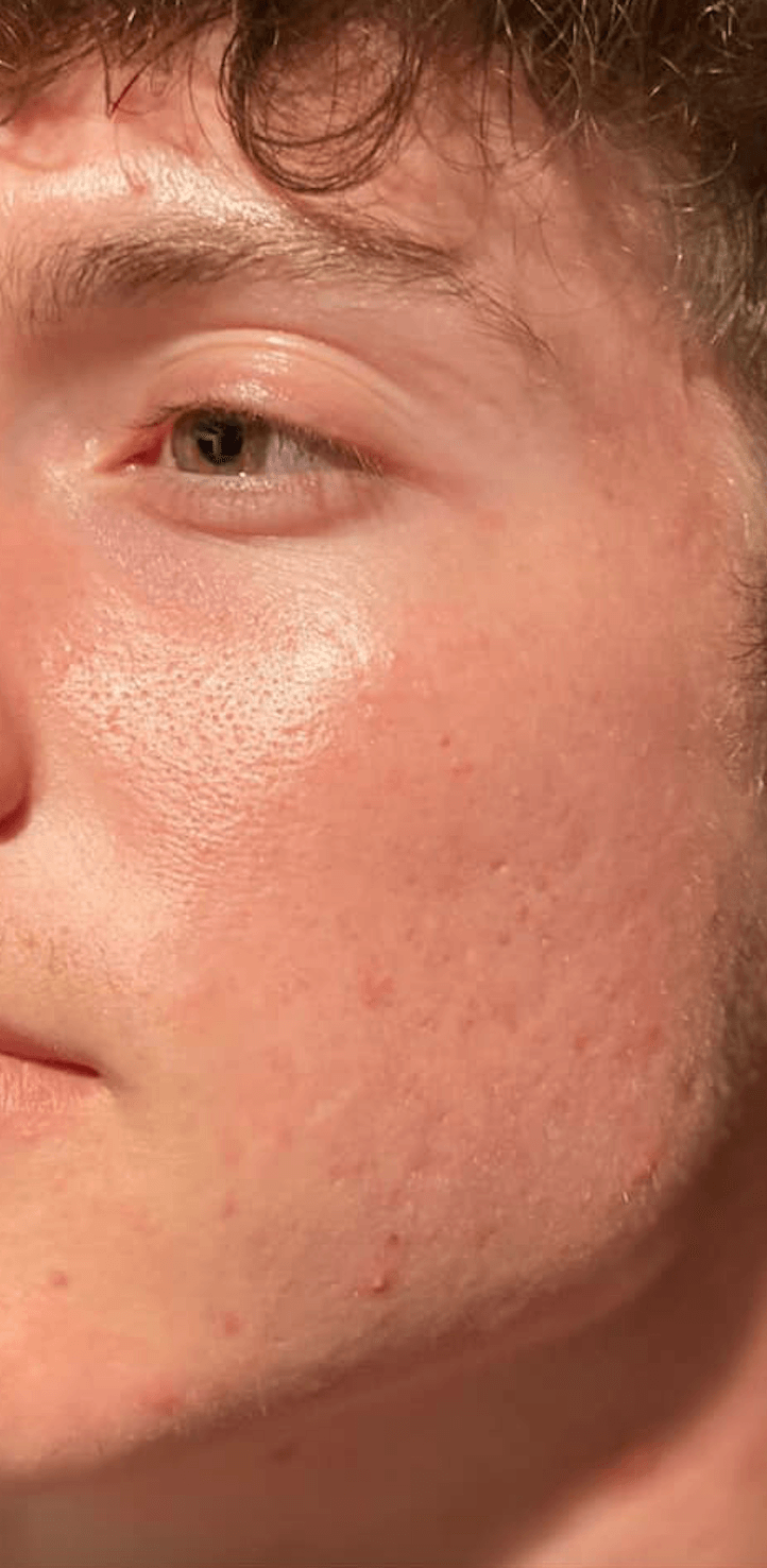 Hydrafacial Brentwood, Nashville Franklin TN