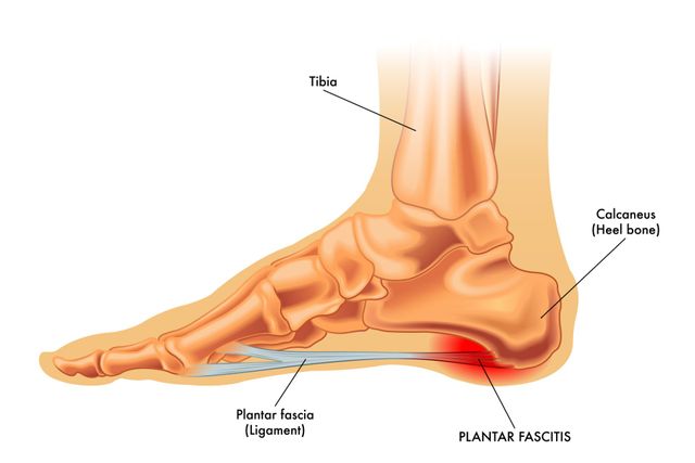 occasional pain in heel of foot