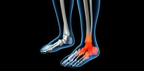 Treatments for heel pain at Footscope