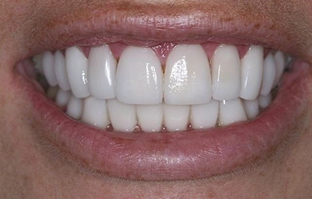 Orthodontics Orange, CA | Dentist in 
