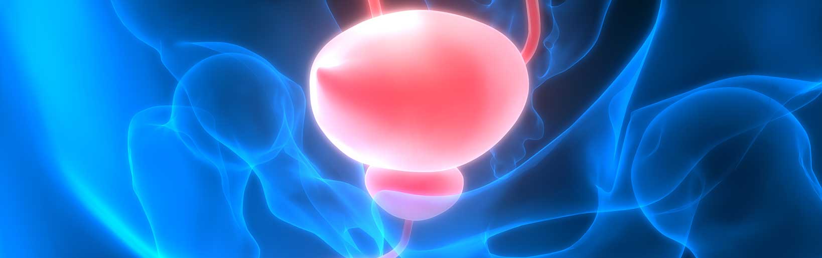 mri-fusion-guided-prostate-biopsy-advanced-prostate-cancer-detection
