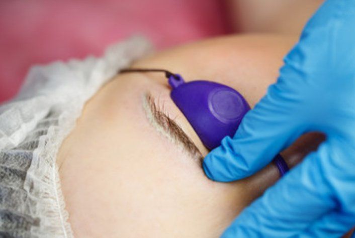 Permanent Makeup Removal in Maryland