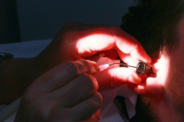 suction ear wax removal suction ear wax removal