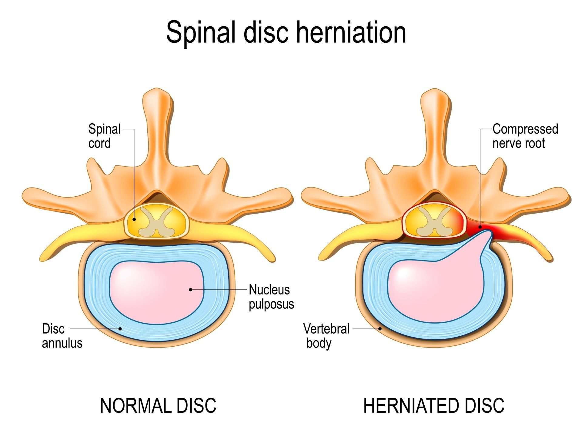 vertebrae and disc anatomy