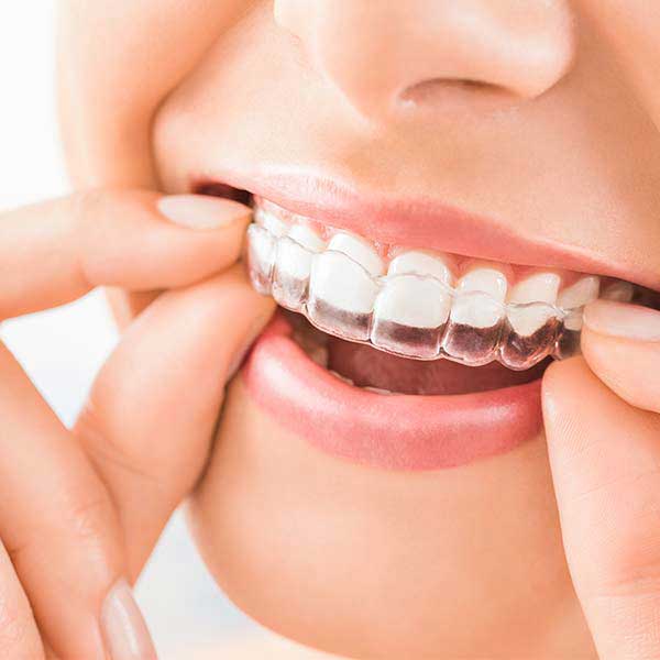 do braces move your teeth everyday