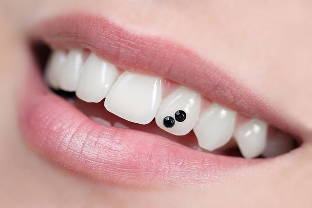 dental gem kit