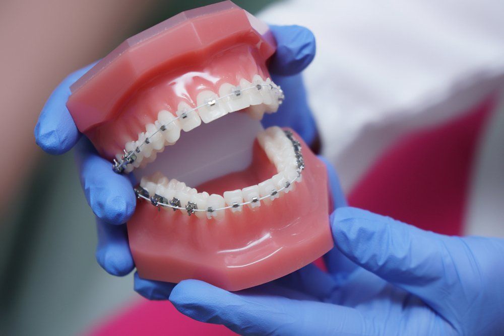 to Keswick Braces & Uxbridge Braces