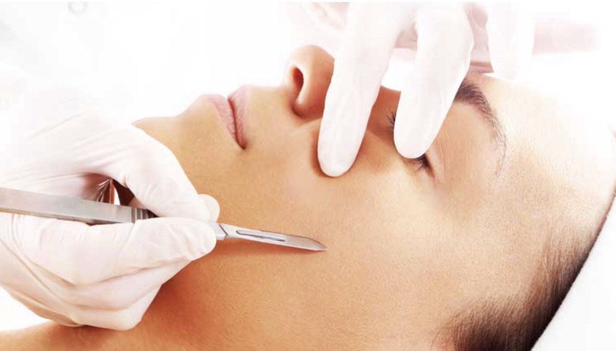 Dermaplaning & Microneedling from Wirral Laser Room