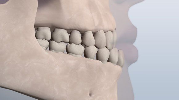 Classification of Teeth | South Jersey Pediatric Dental ...