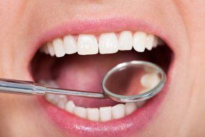 A person that needs general dentistry services in Mulgrave
