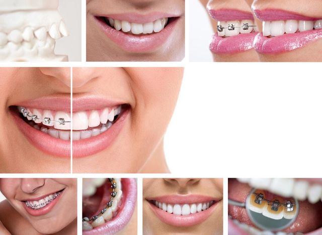 collage of orthodontics