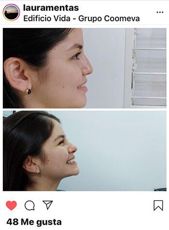 Cirujano Plástico Facial Cirugía Plástica Facial En Cali Colombia