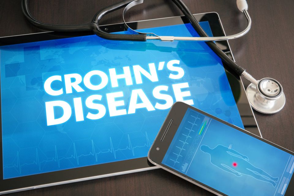 Living With Crohn's Disease What You Should Expect