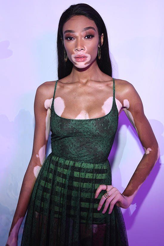 WINNIE HARLOW