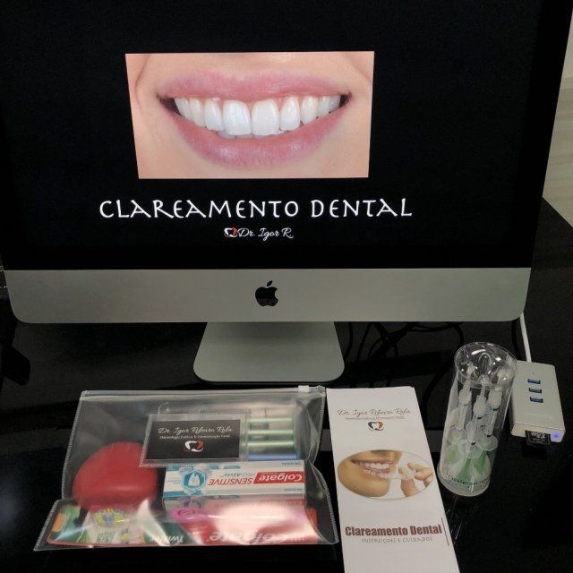 Clareamento Dental em Fortaleza O que você PRECISA saber? Clareamento Dental em Fortaleza O que você PRECISA saber?
