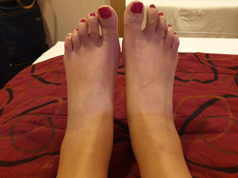 Swollen Ankles on Holiday?