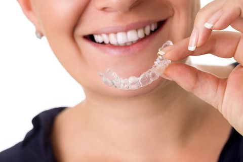 invisalign windsor