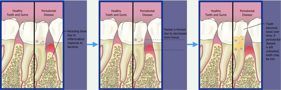 Periodontal Therapy/Microsurgery